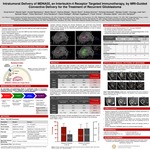 Intratumoral Delivery of MDNA55, an Interleukin-4 Receptor Targeted Immunotherapy, by MRI-Guided Convective Delivery for the Treatment of Recurrent Glioblastoma