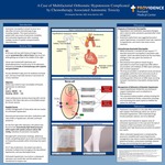 A Case Of Multifactorial Orthostatic Hypotension Complicated By Chemotherapy Associated Autonomic Toxicity by Christopher Bender and Amy Dechet
