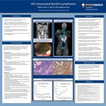 HIV-Associated Burkitt Lymphoma: More than a starry sky appearance by Rahwa Ghebremichael and Amy Dechet